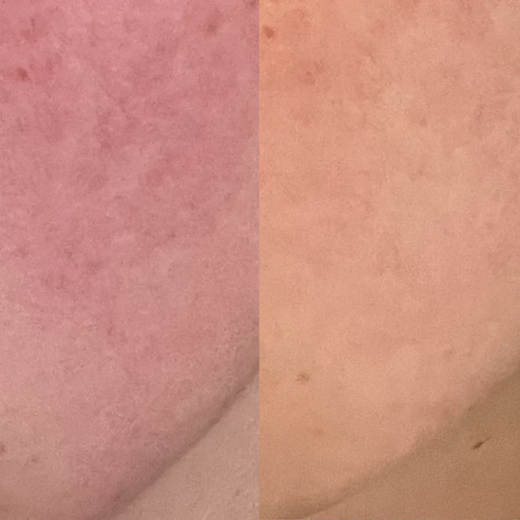 Reflektskincare: Embrace Your Skin's True Radiance