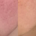 Reflektskincare: Embrace Your Skin's True Radiance